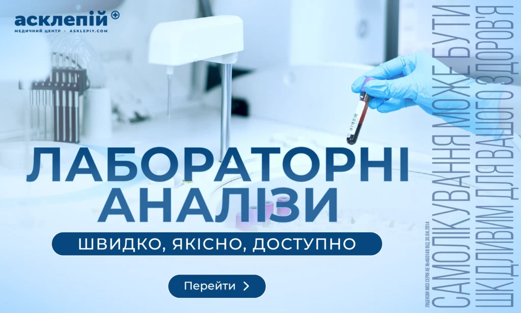 Акційний банер