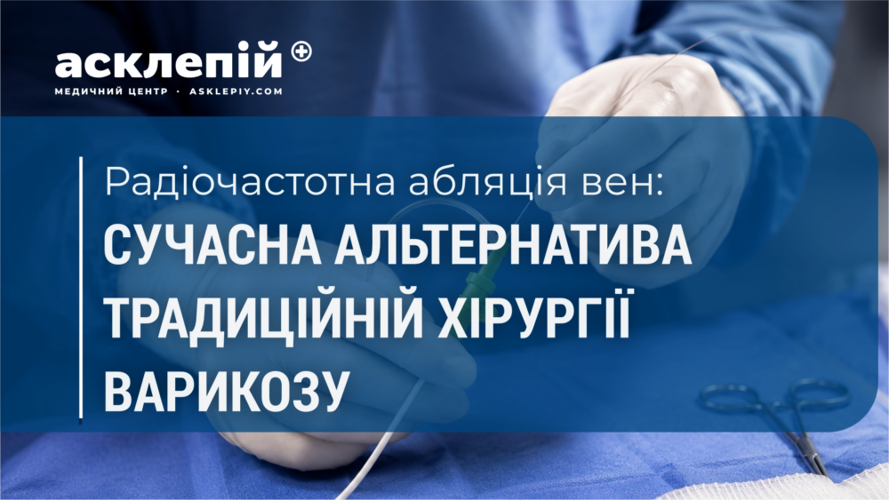 Радіочастотна абляція вен: сучасна альтернатива традиційній хірургії варикозу