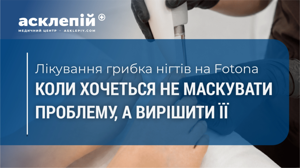 Лікування грибка нігтів на Fotona: коли хочеться не маскувати проблему, а вирішити її