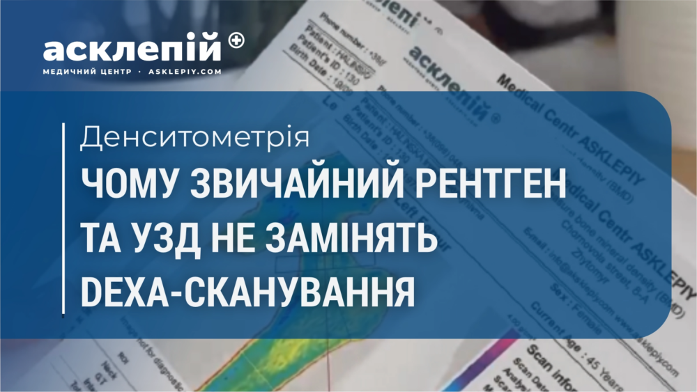 Чому звичайний рентген та узд не замінять DEXA-сканування?