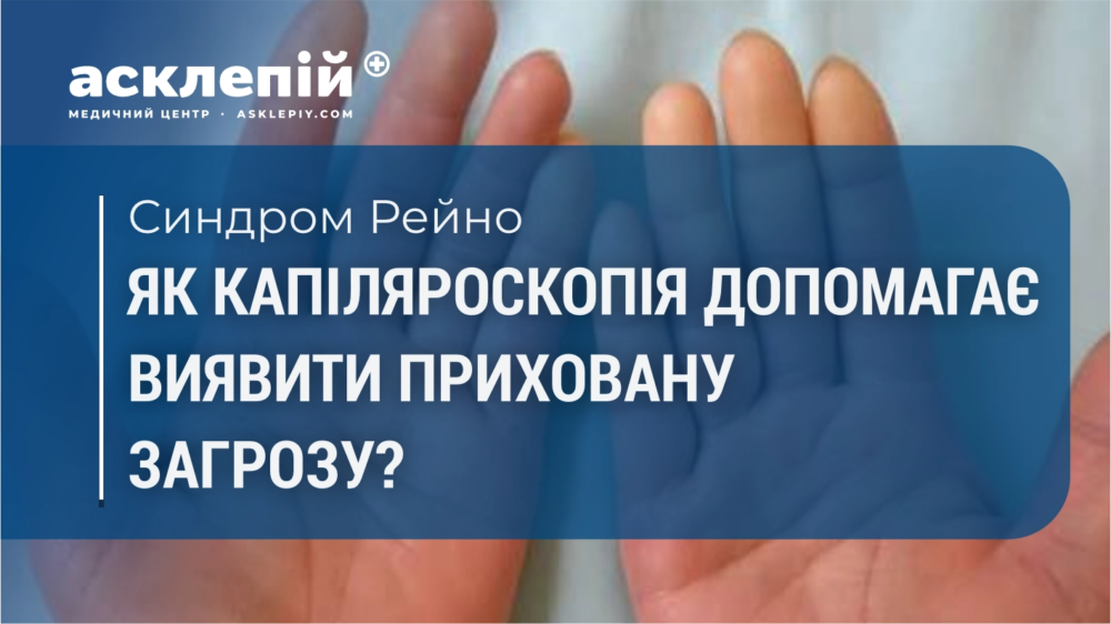 Синдром Рейно: як капіляроскопія допомагає виявити приховану загрозу?